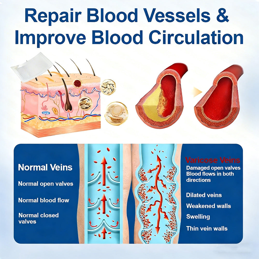 𝐏𝐮𝐫𝐞𝐥𝐨𝐫𝐚® 𝐃𝐢𝐨𝐬𝐦𝐢𝐧 & 𝐀𝐞𝐬𝐜𝐢𝐧 𝐕𝐞𝐢𝐧 𝐂𝐨𝐧𝐭𝐨𝐮𝐫 𝐌𝐢𝐜𝐫𝐨𝐧𝐞𝐞𝐝𝐥𝐞 𝐏𝐚𝐭𝐜𝐡 🌿𝟕-𝐃𝐚𝐲 𝐕𝐢𝐬𝐢𝐛𝐥𝐞 𝐑𝐞𝐬𝐮𝐥𝐭𝐬 𝐟𝐨𝐫 𝐕𝐚𝐫𝐢𝐜𝐨𝐬𝐞 𝐕𝐞𝐢𝐧𝐬 - 𝐀𝐝𝐯𝐚𝐧𝐜𝐞𝐝 𝐇𝐞𝐫𝐛𝐚𝐥 𝐁𝐥𝐞𝐧𝐝 𝐓𝐚𝐫𝐠𝐞𝐭𝐬 𝐒𝐩𝐢𝐝𝐞𝐫 𝐕𝐞𝐢𝐧𝐬 & 𝐑𝐞𝐥𝐢𝐞𝐯𝐞𝐬 𝐇𝐞𝐚𝐯𝐲, 𝐓𝐢𝐫𝐞𝐝 𝐋𝐞𝐠𝐬🦵