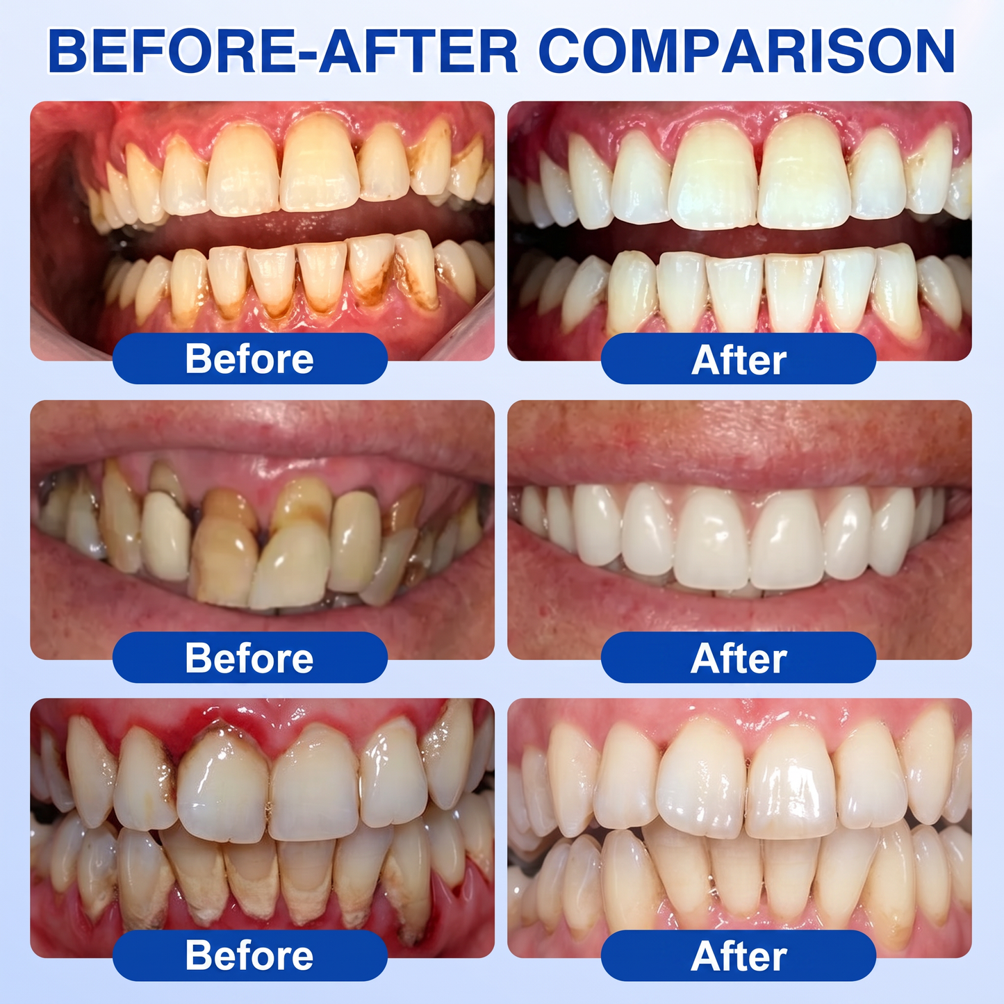 👨‍⚕️🦷𝑷𝒖𝒓𝒆𝒍𝒐𝒓𝒂® GumRevive periodontal repair gel