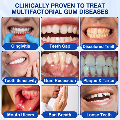 👨‍⚕️🦷𝑷𝒖𝒓𝒆𝒍𝒐𝒓𝒂® GumRevive periodontal repair gel