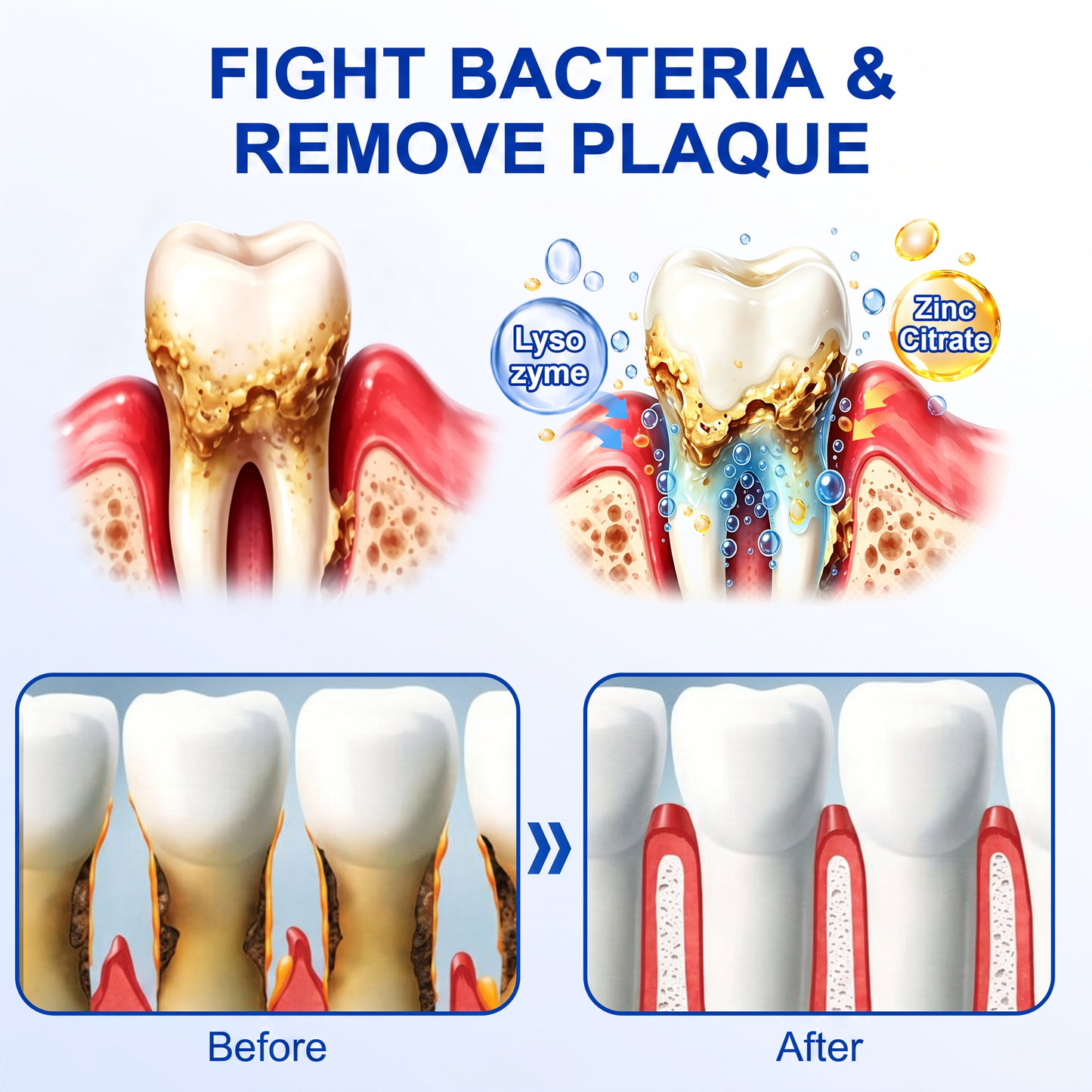 👨‍⚕️🦷𝑷𝒖𝒓𝒆𝒍𝒐𝒓𝒂® GumRevive periodontal repair gel