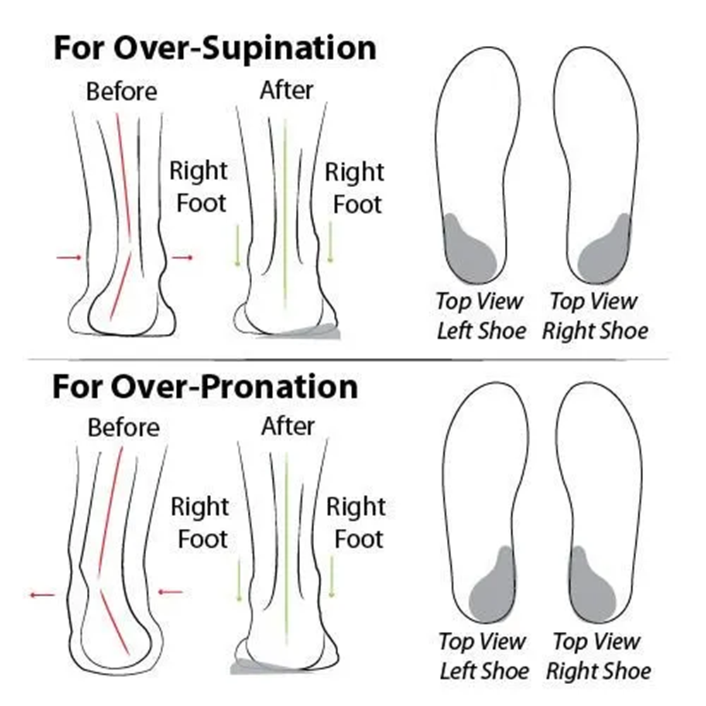 🔥 LAST DAY: 80% OFF - 👑 Women's Orthopedic Comfort Walking Shoes, Slip-On Design, All-Day Arch Support