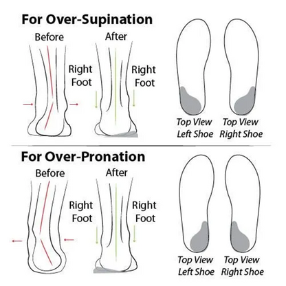🔥 LAST DAY: 80% OFF - 👑 Women's Orthopedic Comfort Walking Shoes, Slip-On Design, All-Day Arch Support