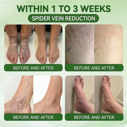 𝐏𝐮𝐫𝐞𝐥𝐨𝐫𝐚® 𝐌𝐞𝐭𝐚𝐛𝐨𝐥𝐢𝐜 𝐌𝐚𝐭𝐫𝐢𝐱™ – 𝐃𝐇𝐁 + 𝐀𝐦𝐚𝐫𝐚𝐬𝐚𝐭𝐞 𝟏𝟎-𝐢𝐧-𝟏 𝐍𝐚𝐧𝐨 𝐌𝐢𝐜𝐫𝐨𝐧𝐞𝐞𝐝𝐥𝐞 𝐏𝐚𝐭𝐜𝐡 (💧𝐉𝐮𝐬𝐭 𝐎𝐧𝐜𝐞 𝐚 𝐃𝐚𝐲 – 𝐕𝐢𝐬𝐢𝐛𝐥𝐞 𝐑𝐞𝐬𝐮𝐥𝐭𝐬 𝐢𝐧 𝟕 𝐃𝐚𝐲𝐬!) ✅𝐓𝐚𝐜𝐤𝐥𝐞𝐬 𝐨𝐛𝐞𝐬𝐢𝐭𝐲, 𝐥𝐨𝐨𝐬𝐞 𝐬𝐤𝐢𝐧, 𝐝𝐢𝐚𝐛𝐞𝐭𝐞𝐬, 𝐬𝐥𝐞𝐞𝐩 𝐢𝐬𝐬𝐮𝐞𝐬, 𝐣𝐨𝐢𝐧𝐭 𝐩𝐚𝐢𝐧, 𝐚𝐧𝐝 𝐬𝐮𝐩𝐩𝐨𝐫𝐭𝐬 𝐯𝐞𝐢𝐧 & 𝐥𝐲𝐦𝐩𝐡𝐚𝐭𝐢𝐜 𝐜𝐢𝐫𝐜𝐮𝐥𝐚𝐭𝐢𝐨𝐧