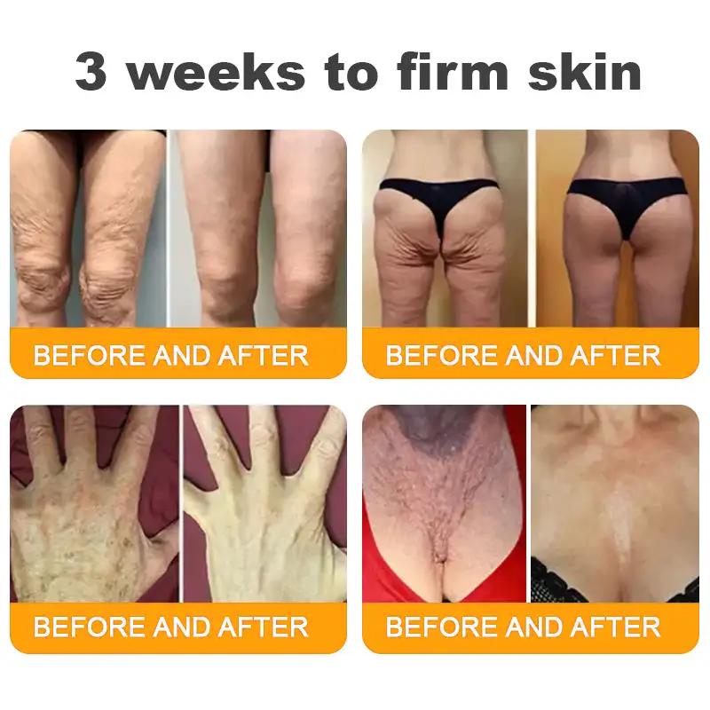 Made and Shipped from USA ✨ Purelora® Bee Venom Skin Restoration Cream ⏰ LAST DAY 80% OFF🛒