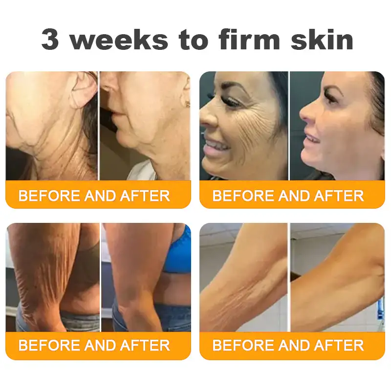 Made and Shipped from USA ✨ Purelora® Bee Venom Skin Restoration Cream ⏰ LAST DAY 80% OFF🛒