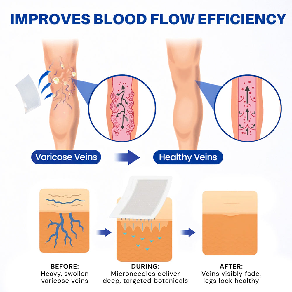 𝐏𝐮𝐫𝐞𝐥𝐨𝐫𝐚® 𝐃𝐢𝐨𝐬𝐦𝐢𝐧 & 𝐀𝐞𝐬𝐜𝐢𝐧 𝐕𝐞𝐢𝐧 𝐂𝐨𝐧𝐭𝐨𝐮𝐫 𝐌𝐢𝐜𝐫𝐨𝐧𝐞𝐞𝐝𝐥𝐞 𝐏𝐚𝐭𝐜𝐡 🌿𝟕-𝐃𝐚𝐲 𝐕𝐢𝐬𝐢𝐛𝐥𝐞 𝐑𝐞𝐬𝐮𝐥𝐭𝐬 𝐟𝐨𝐫 𝐕𝐚𝐫𝐢𝐜𝐨𝐬𝐞 𝐕𝐞𝐢𝐧𝐬 - 𝐀𝐝𝐯𝐚𝐧𝐜𝐞𝐝 𝐇𝐞𝐫𝐛𝐚𝐥 𝐁𝐥𝐞𝐧𝐝 𝐓𝐚𝐫𝐠𝐞𝐭𝐬 𝐒𝐩𝐢𝐝𝐞𝐫 𝐕𝐞𝐢𝐧𝐬 & 𝐑𝐞𝐥𝐢𝐞𝐯𝐞𝐬 𝐇𝐞𝐚𝐯𝐲, 𝐓𝐢𝐫𝐞𝐝 𝐋𝐞𝐠𝐬🦵