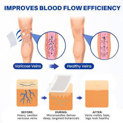 𝐏𝐮𝐫𝐞𝐥𝐨𝐫𝐚® 𝐃𝐢𝐨𝐬𝐦𝐢𝐧 & 𝐀𝐞𝐬𝐜𝐢𝐧 𝐕𝐞𝐢𝐧 𝐂𝐨𝐧𝐭𝐨𝐮𝐫 𝐌𝐢𝐜𝐫𝐨𝐧𝐞𝐞𝐝𝐥𝐞 𝐏𝐚𝐭𝐜𝐡 🌿𝟕-𝐃𝐚𝐲 𝐕𝐢𝐬𝐢𝐛𝐥𝐞 𝐑𝐞𝐬𝐮𝐥𝐭𝐬 𝐟𝐨𝐫 𝐕𝐚𝐫𝐢𝐜𝐨𝐬𝐞 𝐕𝐞𝐢𝐧𝐬 - 𝐀𝐝𝐯𝐚𝐧𝐜𝐞𝐝 𝐇𝐞𝐫𝐛𝐚𝐥 𝐁𝐥𝐞𝐧𝐝 𝐓𝐚𝐫𝐠𝐞𝐭𝐬 𝐒𝐩𝐢𝐝𝐞𝐫 𝐕𝐞𝐢𝐧𝐬 & 𝐑𝐞𝐥𝐢𝐞𝐯𝐞𝐬 𝐇𝐞𝐚𝐯𝐲, 𝐓𝐢𝐫𝐞𝐝 𝐋𝐞𝐠𝐬🦵