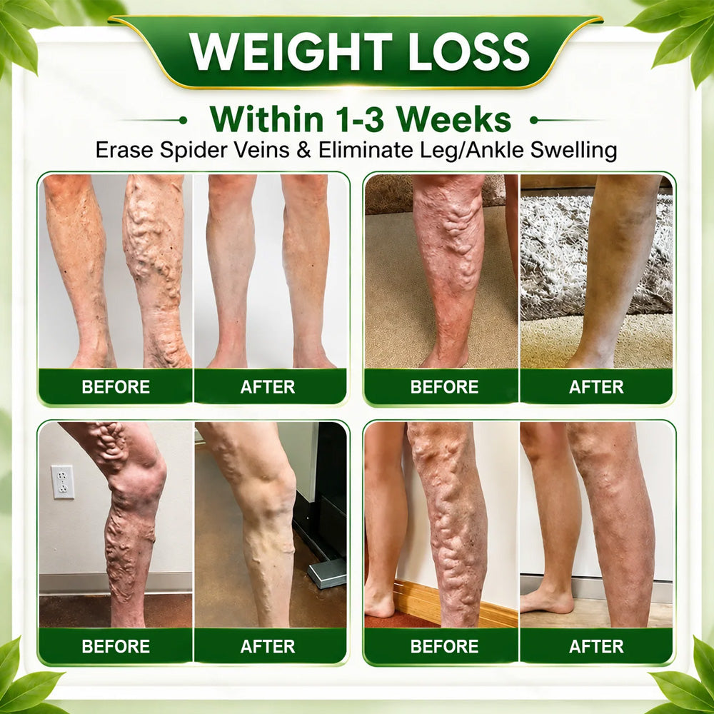 🇺🇸👩‍⚕️𝐎𝐟𝐟𝐢𝐜𝐢𝐚𝐥 𝐁𝐫𝐚𝐧𝐝 𝐒𝐭𝐨𝐫𝐞 |🌿𝑷𝒖𝒓𝒆𝒍𝒐𝒓𝒂® 𝑩𝒆𝒓𝒃𝒆𝒓𝒊𝒏𝒆 𝑴𝒐𝒓𝒊𝒏𝒈𝒂- 𝑩𝒆𝒆 𝑽𝒆𝒏𝒐𝒎 Metabolic Wellness Foot Soak Beads