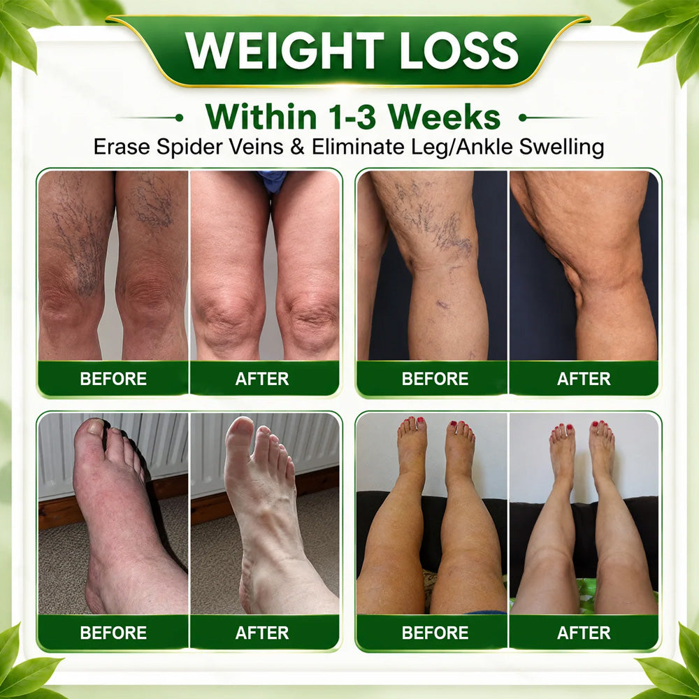 🇺🇸👩‍⚕️𝐎𝐟𝐟𝐢𝐜𝐢𝐚𝐥 𝐁𝐫𝐚𝐧𝐝 𝐒𝐭𝐨𝐫𝐞 |🌿𝑷𝒖𝒓𝒆𝒍𝒐𝒓𝒂® 𝑩𝒆𝒓𝒃𝒆𝒓𝒊𝒏𝒆 𝑴𝒐𝒓𝒊𝒏𝒈𝒂- 𝑩𝒆𝒆 𝑽𝒆𝒏𝒐𝒎 Metabolic Wellness Foot Soak Beads