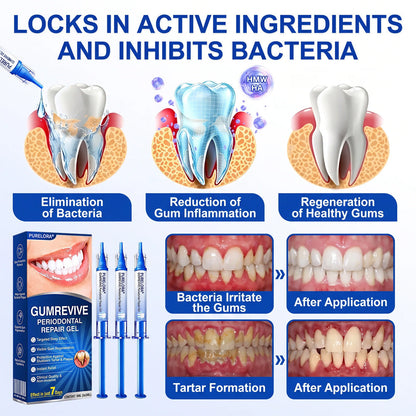 👨‍⚕️🦷𝑷𝒖𝒓𝒆𝒍𝒐𝒓𝒂® GumRevive periodontal repair gel