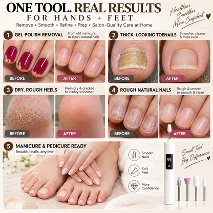 Mresio® Professional Electric Nail Drill Kit – Digital Speed Manicure & Pedicure System